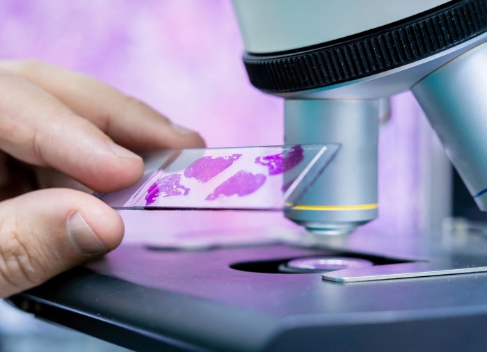 Rezultaty badań cytologicznych według skali Papanicolau i systemu Bethesda – Przegląd i interpretacja