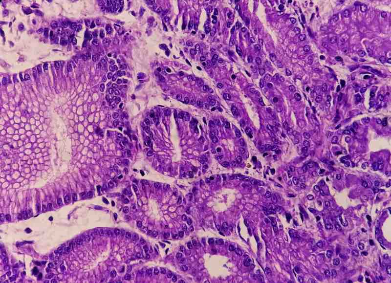 Czerwone krwinki w czasie ciąży – co warto wiedzieć