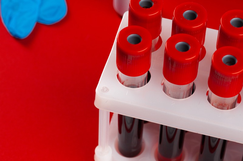 Kiedy warto zbadać grupę krwi – wskazania do wykonania badania